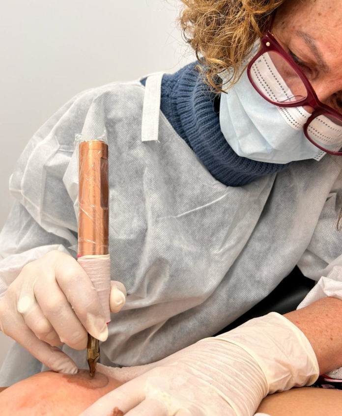 Una professional d'infermeria de l'hospital de Palamós practica una micropigmentació de mugró a una pacient Data de publicació: dijous 23 de maig del 2024, 11:55 Localització: Palamós Autor: Imatge cedida a l'ACN per l'Hospital de Palamós Una professional d'infermeria de l'hospital de Palamós practica una micropigmentació de mugró a una pacient Data de publicació: dijous 23 de maig del 2024, 11:55 Localització: Palamós Autor: Imatge cedida a l'ACN per l'Hospital de Palamós