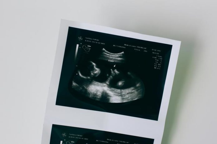 4c430951-f3a2-4ffe-bb12-9b7be745e5da_medium Road to motherhood, a sonogram photo / Valeriia Svietlova via Pexels